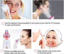 Load image into Gallery viewer, Zephta® Facial Pore Cleanser